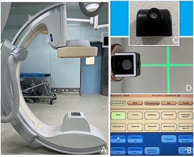 Laser Navigation Combined With XperCT Technology Assisted Puncture of Brainstem Hemorrhage